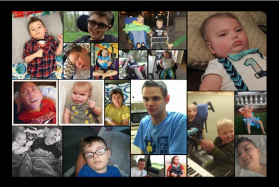 Rare metabolic epilepsies