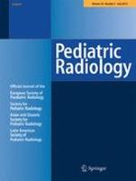 Distinctive pattern of restricted diffusion in a neonate with molybdenum cofactor deficiency