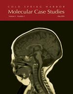 Discovery of a potentially deleterious variant in TMEM87B in a patient with a hemizygous 2q13 microdeletion suggests a recessive condition characterized by congenital heart disease and restrictive cardiomyopathy